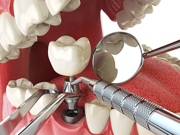Best Emergency Treatment for Oral Infections in Concord, MI